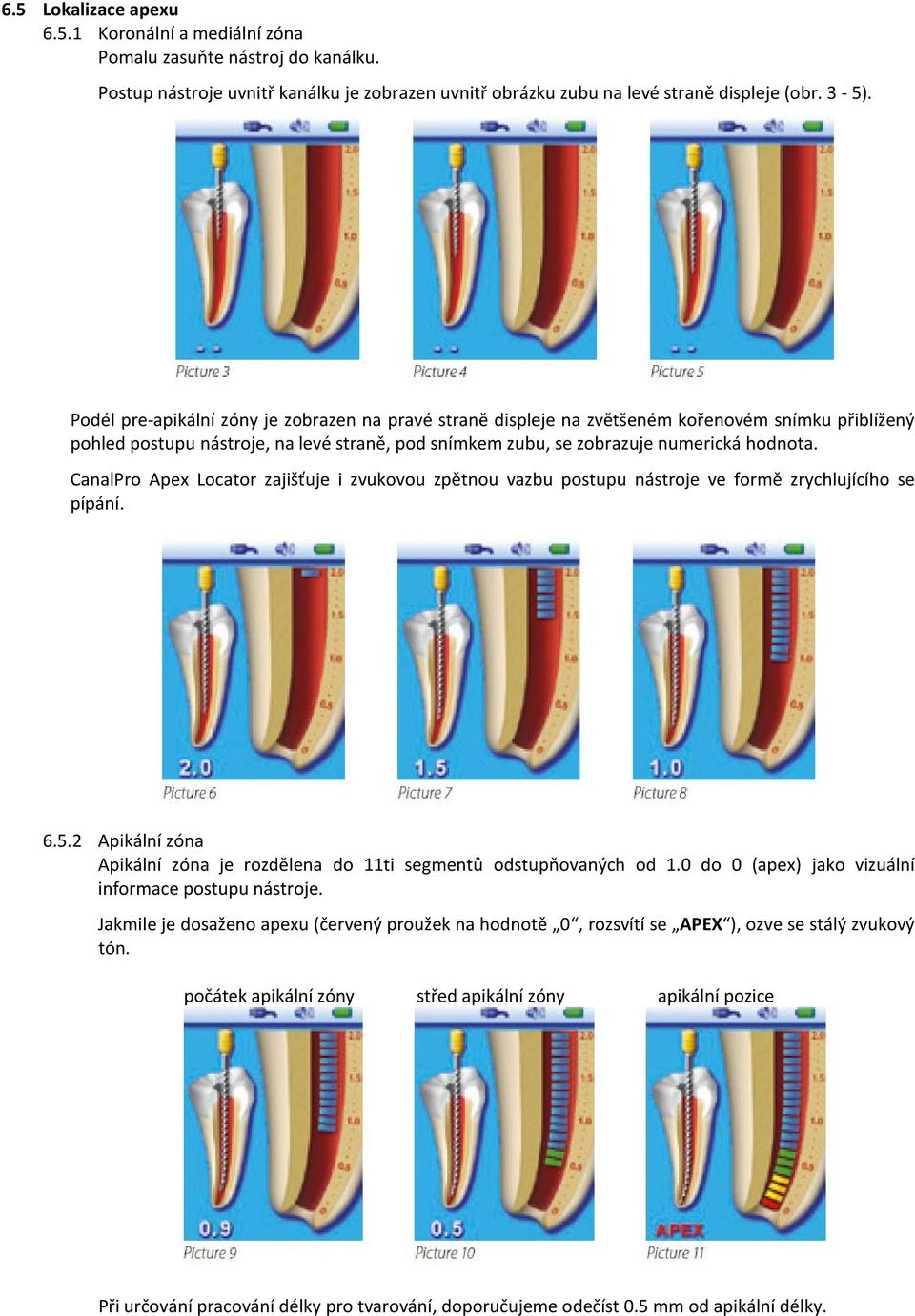 CanalPro Apex Locator zajišťuje i zvukovou zpětnou vazbu postupu nástroje ve formě zrychlujícího se pípání. 6.5.2 Apikální zóna Apikální zóna je rozdělena do 11ti segmentů odstupňovaných od 1.