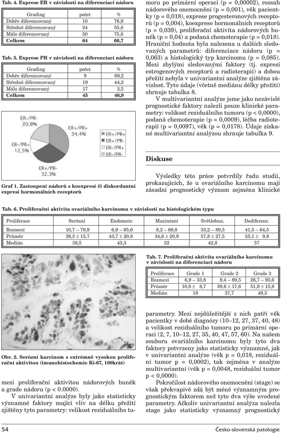 Exprese PR v závislosti na diferenciaci nádoru Grading počet % Dobře diferencovaný 9 69,2 Středně diferencovaný 19 44,2 Málo diferencovaný 17 2,5 Celkem 45 46,9 mezi proliferační aktivitou nádorových