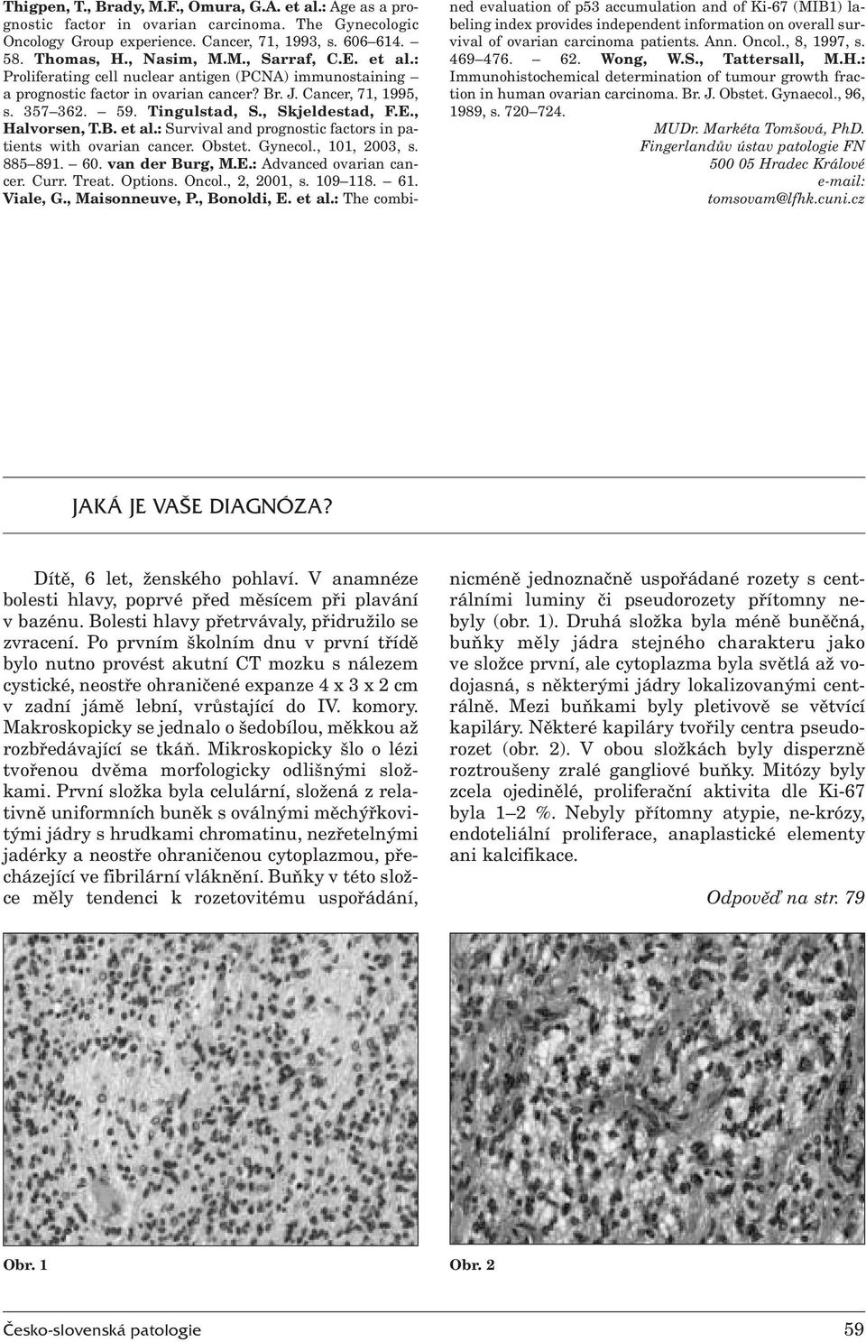 Obstet. Gynecol., 101, 2003, s. 885 891. 60. van der Burg, M.E.: Advanced ovarian cancer. Curr. Treat. Options. Oncol., 2, 2001, s. 109 118. 61. Viale, G., Maisonneuve, P., Bonoldi, E. et al.