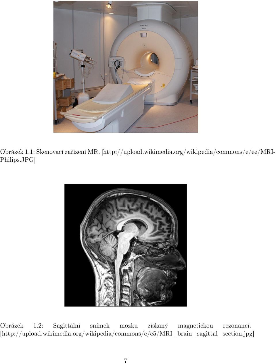 2: Sagittální snímek mozku získaný magnetickou rezonancí.