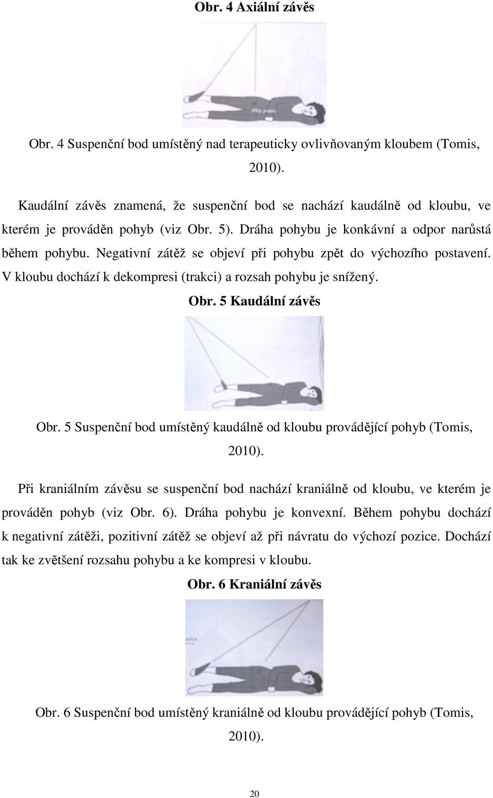 Negativní zátěž se objeví při pohybu zpět do výchozího postavení. V kloubu dochází k dekompresi (trakci) a rozsah pohybu je snížený. Obr. 5 Kaudální závěs Obr.