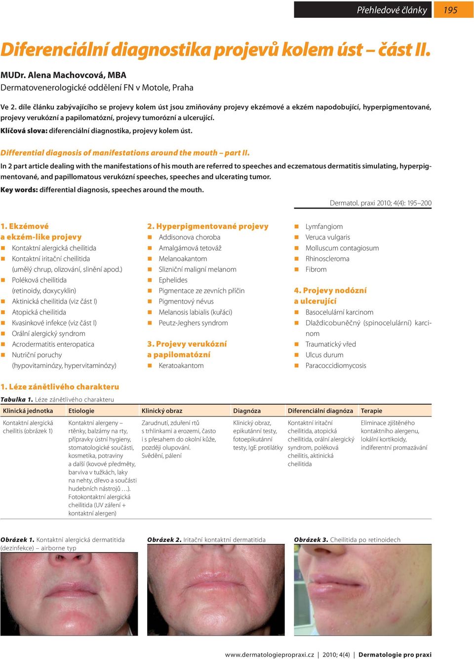 Klíčová slova: diferenciální diagnostika, projevy kolem úst. Differential diagnosis of manifestations around the mouth part II.