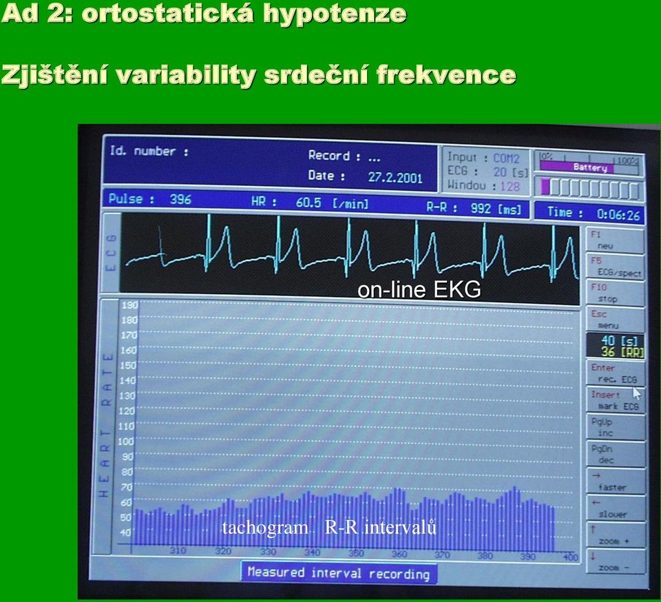 variability srdeční