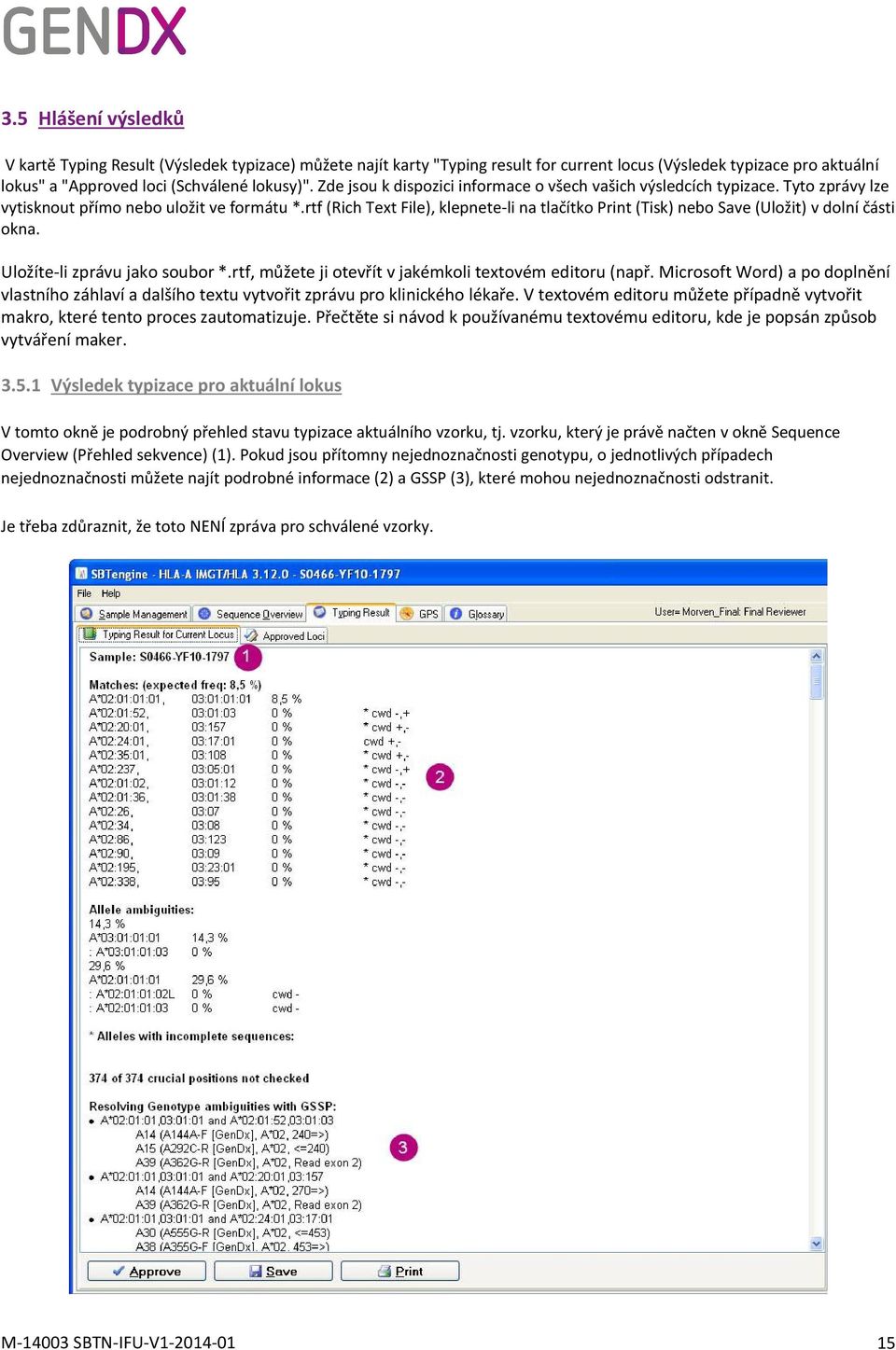 rtf (Rich Text File), klepnete-li na tlačítko Print (Tisk) nebo Save (Uložit) v dolní části okna. Uložíte-li zprávu jako soubor *.rtf, můžete ji otevřít v jakémkoli textovém editoru (např.