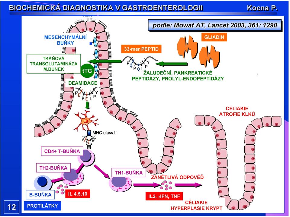 BUNĚK ttg DEAMIDACE ŽALUDEČNÍ, PANKREATICKÉ PEPTIDÁZY, PROLYL-ENDOPEPTIDÁZY CÉLIAKIE ATROFIE