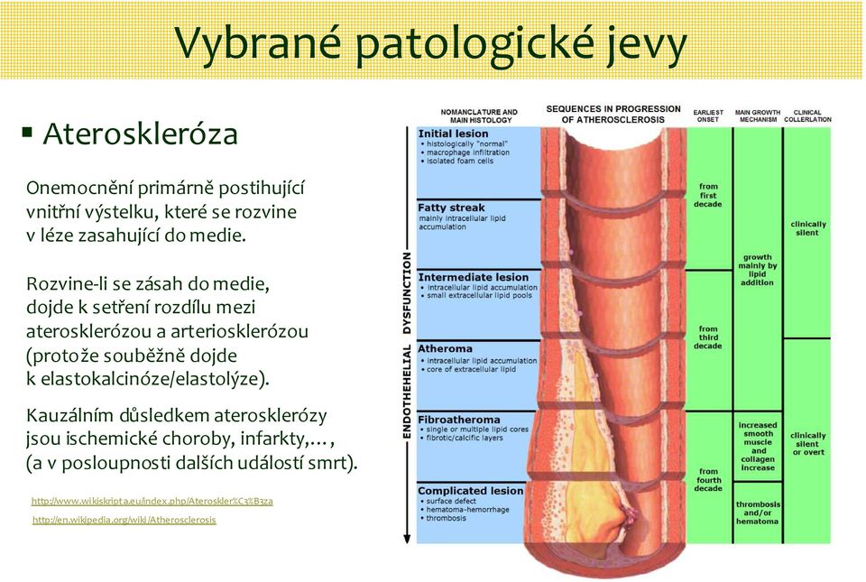 Rozvine-li se zásah do medie, dojde k setřenírozdílu mezi aterosklerózou a arteriosklerózou (protože souběžnědojde k