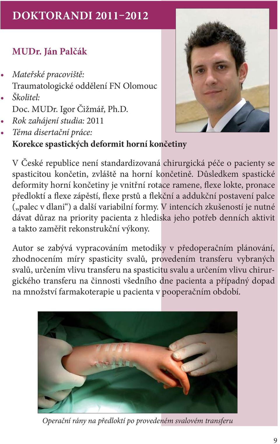 Důsledkem spastické deformity horní končetiny je vnitřní rotace ramene, flexe lokte, pronace předloktí a flexe zápěstí, flexe prstů a flekční a addukční postavení palce ( palec v dlani ) a další