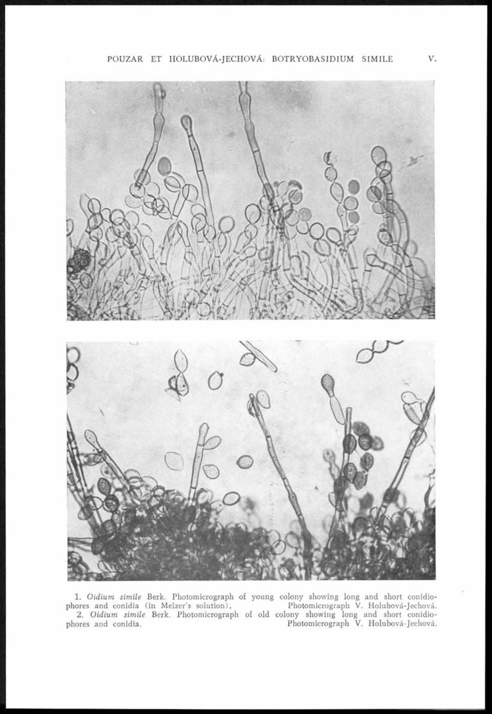 Photomicrograph of young colony showing long and short conidiophores and conidia (in Melzer s