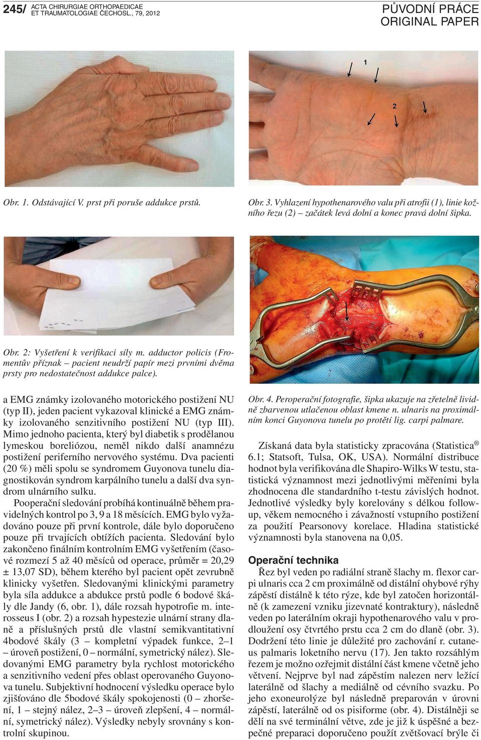 adductor policis (Fromentův příznak pacient neudrží papír mezi prvními dvěma prsty pro nedostatečnost addukce palce).