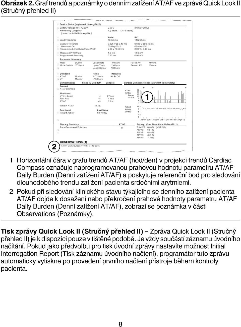 naprogramovanou prahovou hodnotu parametru AT/AF Daily Burden (Denní zatížení AT/AF) a poskytuje referenční bod pro sledování dlouhodobého trendu zatížení pacienta srdečními arytmiemi.