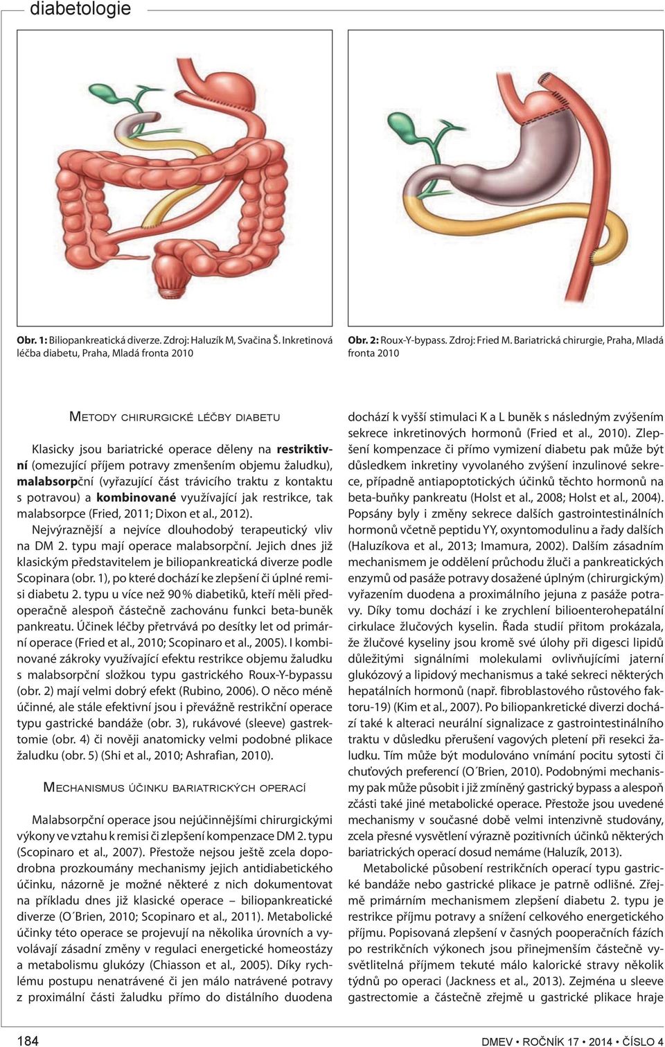 malabsorpční (vyřazující část trávicího traktu z kontaktu s potravou) a kombinované využívající jak restrikce, tak malabsorpce (Fried, 2011; Dixon et al., 2012).