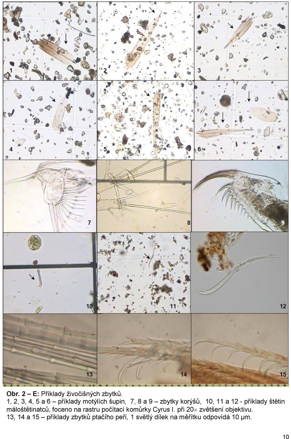 12 - příklady štětin máloštětinatců, foceno na rastru počítací komůrky Cyrus