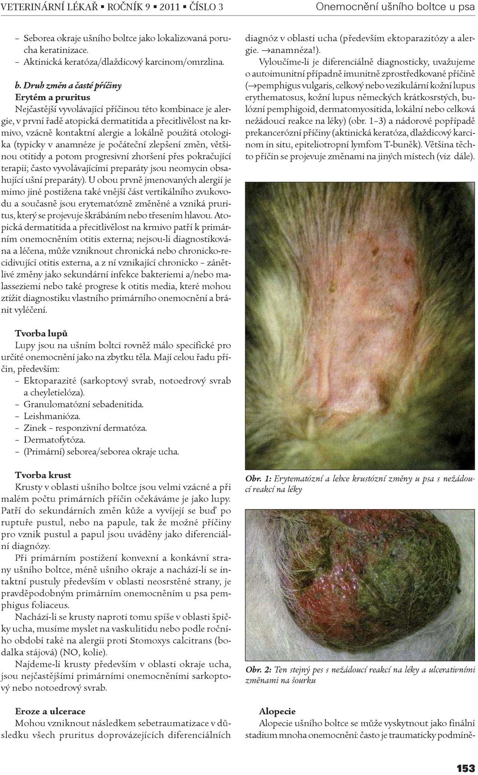 ltce jako lokalizovaná porucha keratinizace. Aktinická keratóza/dlaždicový karcinom/omrzlina. b.