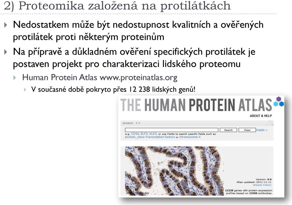 specifických protilátek je postaven projekt pro charakterizaci lidského proteomu