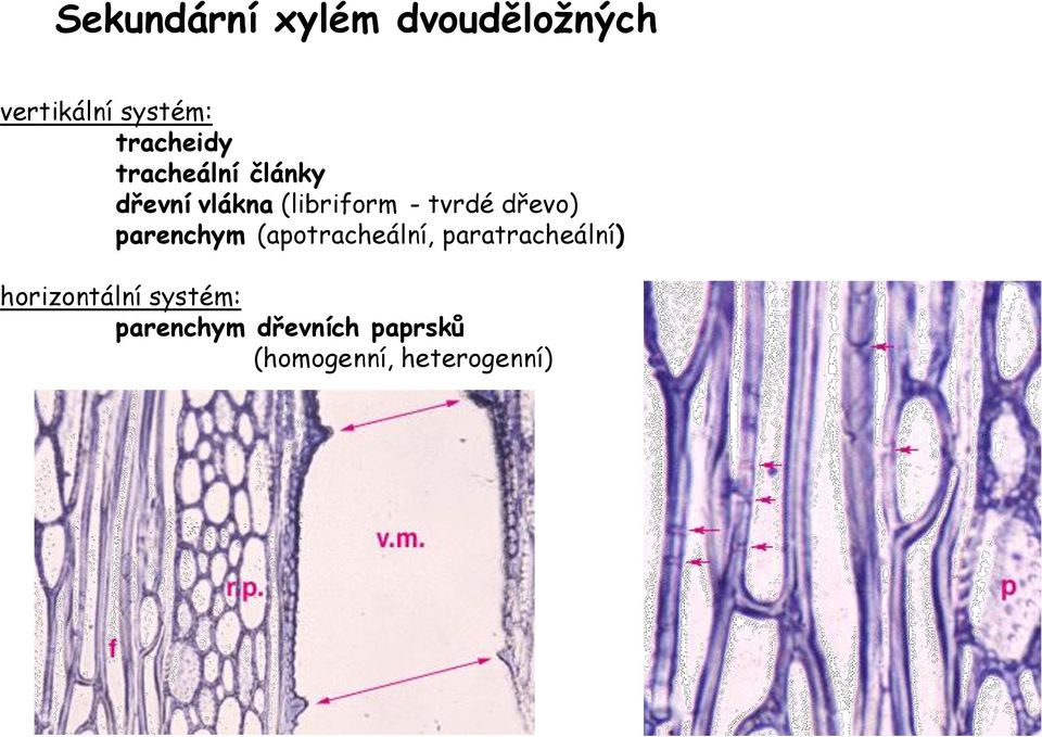 tvrdé dřevo) parenchym (apotracheální, paratracheální)