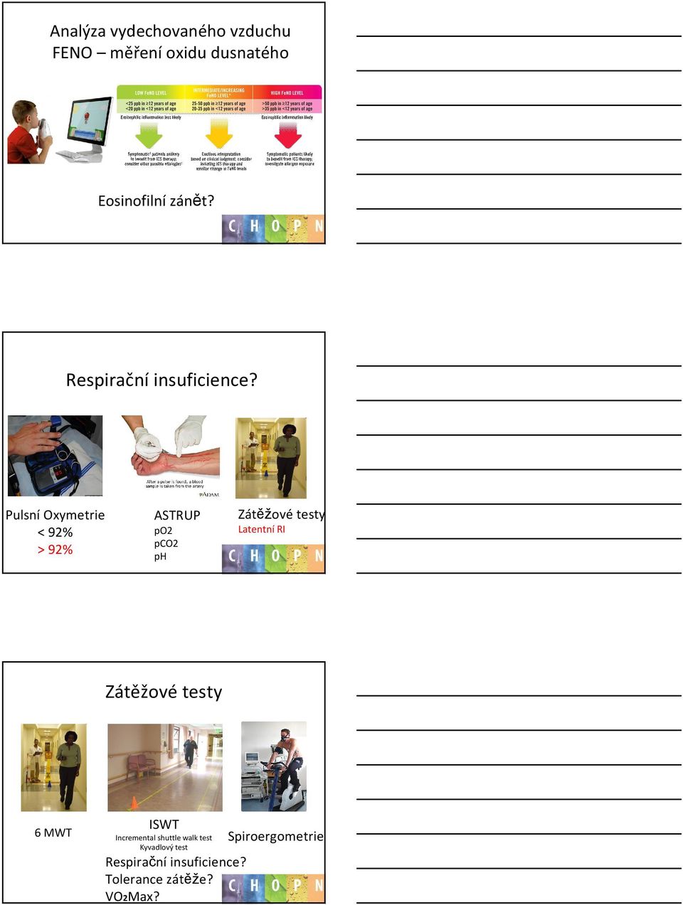 Pulsní Oxymetrie < 92% > 92% ASTRUP po2 pco2 ph Zátěžové testy Latentní RI