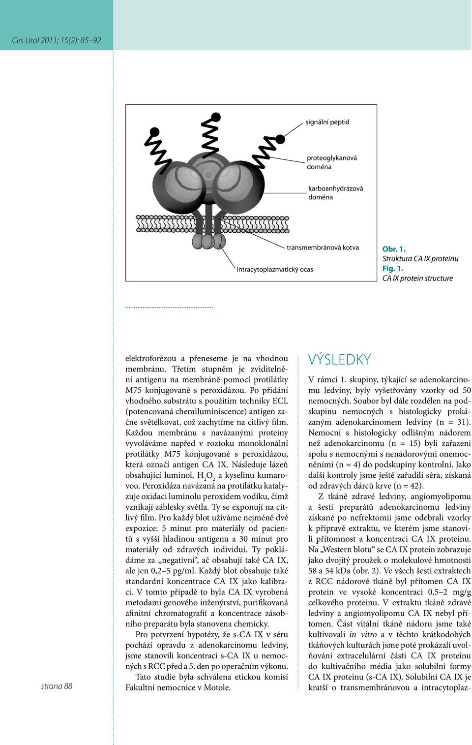 Nemocní s histologicky odlišným nádorem než adenokarcinomu (n = 15) byli zařazeni spolu s nemocnými s nenádorovými onemocněními (n = 4) do podskupiny kontrolní.