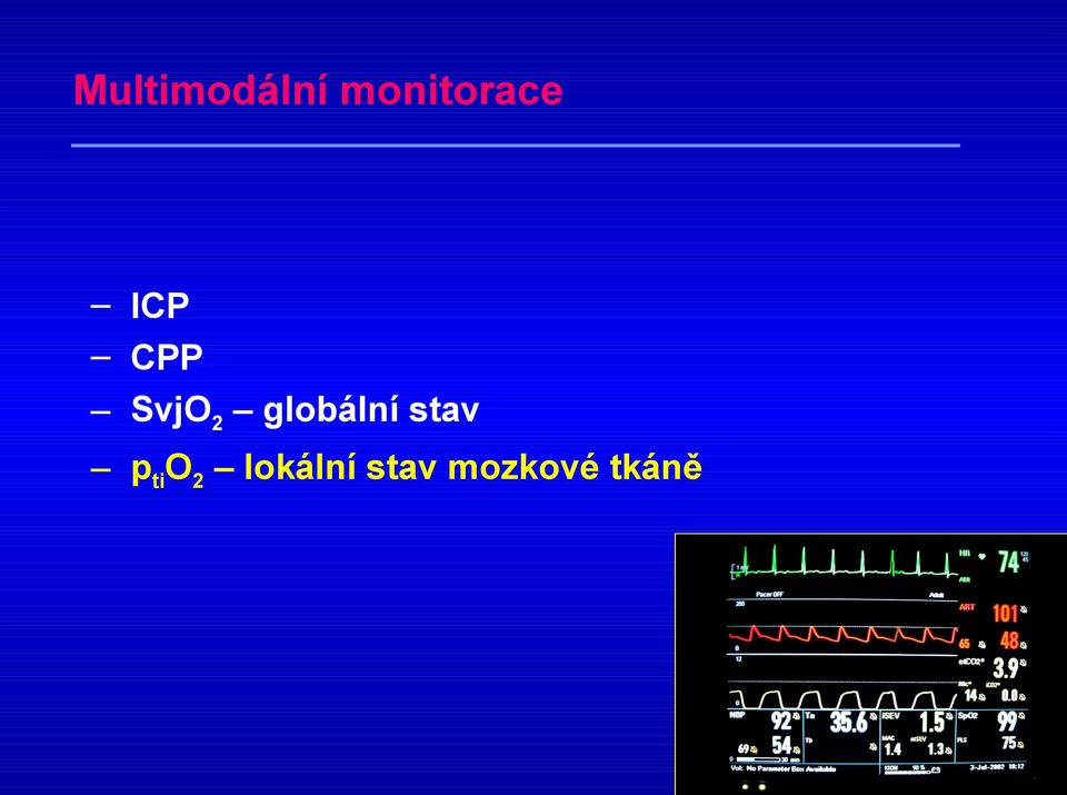 SvjO2 globální stav