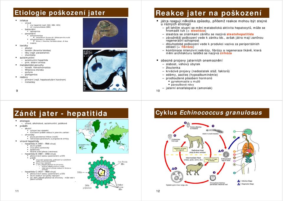 paracetamol) chemikálie autoimunitní autoimunitní hepatitida prim. biliární cirhóza metabolické poruchy heredit. hemochromatóza Wilsonova choroba porfyrie glykogenóza nádory primární (nejč.