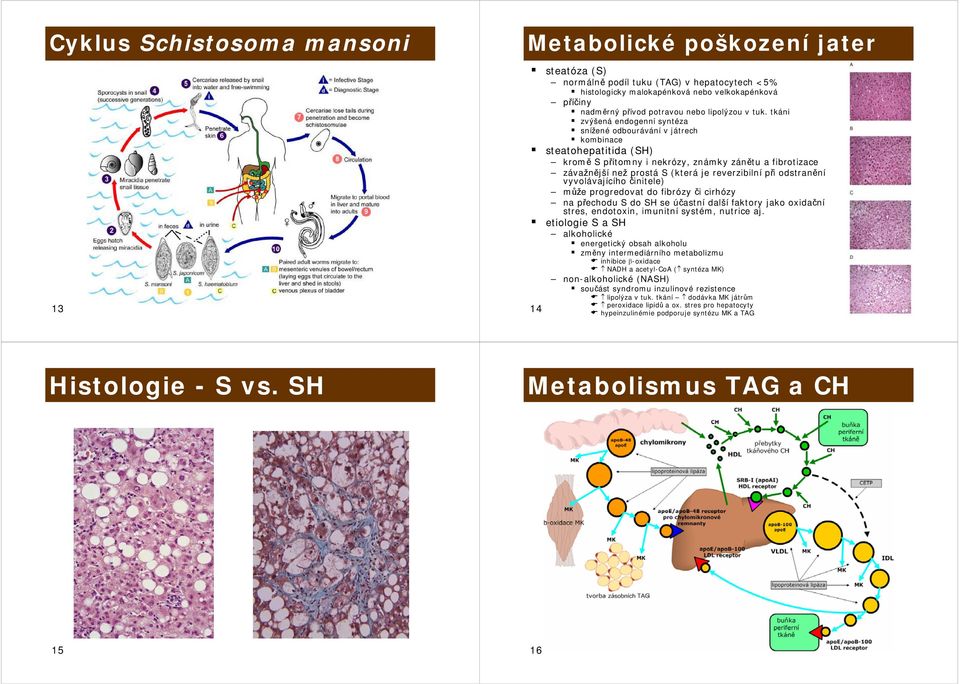 tkáni zvýšená endogenní syntéza snížené odbourávání v játrech kombinace steatohepatitida (SH) kromě S přítomny i nekrózy, známky zánětu a fibrotizace závažnější než prostá S (která je reverzibilní