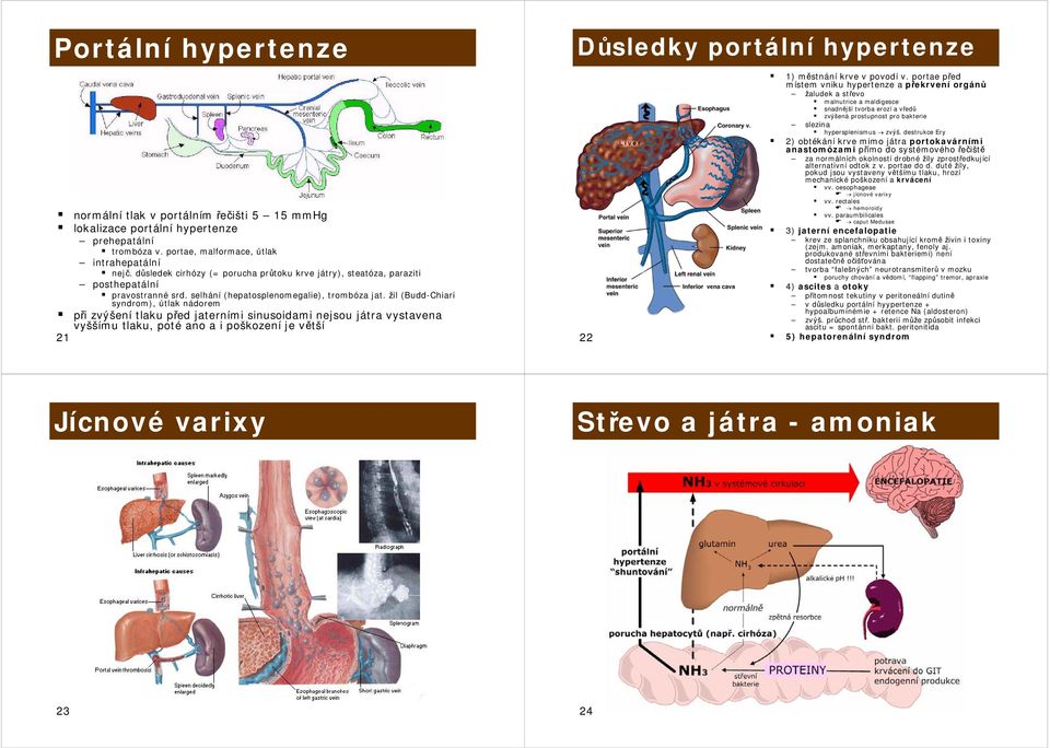 žil (Budd-Chiari syndrom), útlak nádorem při zvýšení tlaku před jaterními sinusoidami nejsou játra vystavena vyššímu tlaku, poté ano a i poškození je větší 21 Důsledky portální hypertenze 22 1)