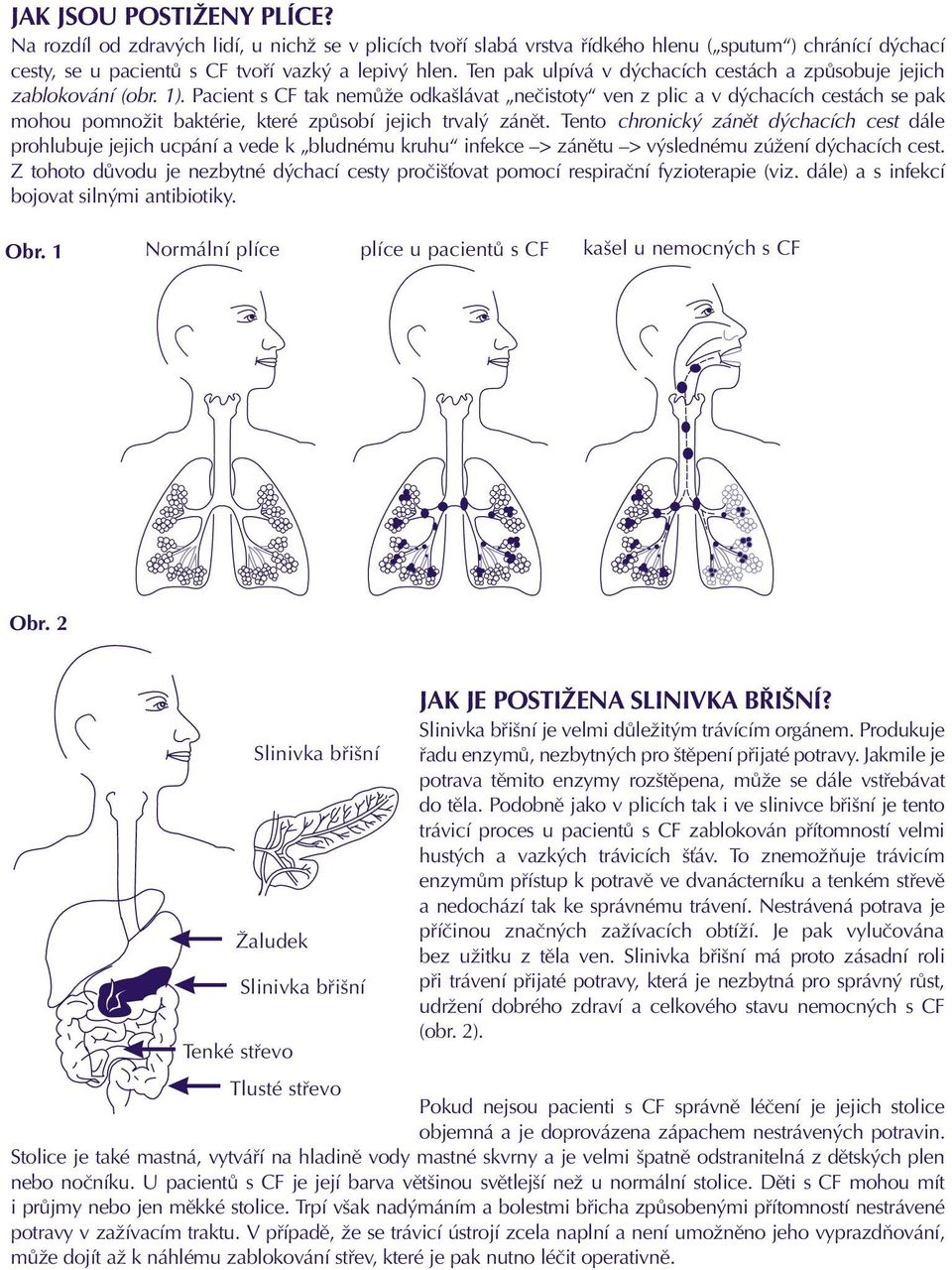 Pacient s CF tak nemûïe odka lávat neãistoty ven z plic a v d chacích cestách se pak mohou pomnoïit baktérie, které zpûsobí jejich trval zánût.