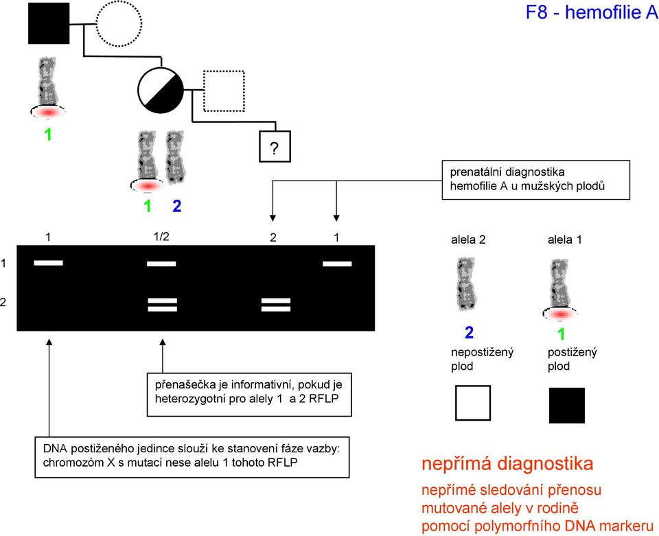 informativní, pokud je heterozygotní pro alely 1 a 2 RFLP 2 nepostižený plod 1 postižený plod DNA