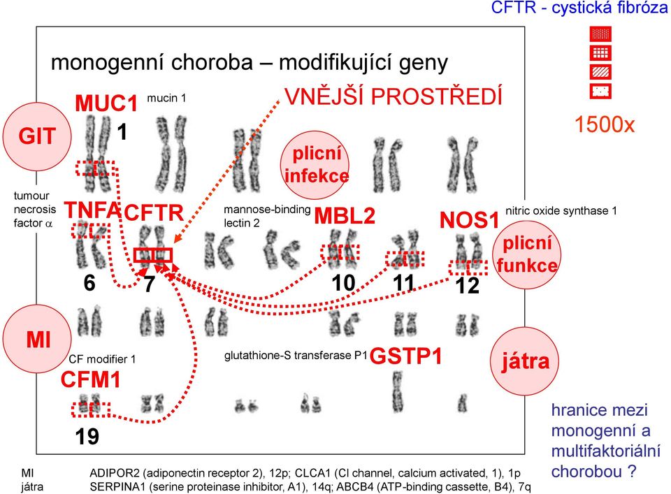 CFM1 19 glutathione-s transferase P1 GSTP1 játra ADIPOR2 (adiponectin receptor 2), 12p; CLCA1 (Cl channel, calcium activated, 1), 1p