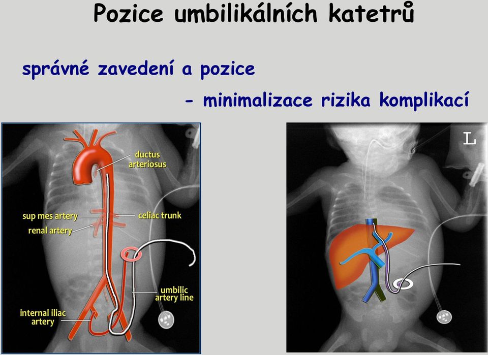 zavedení a pozice -