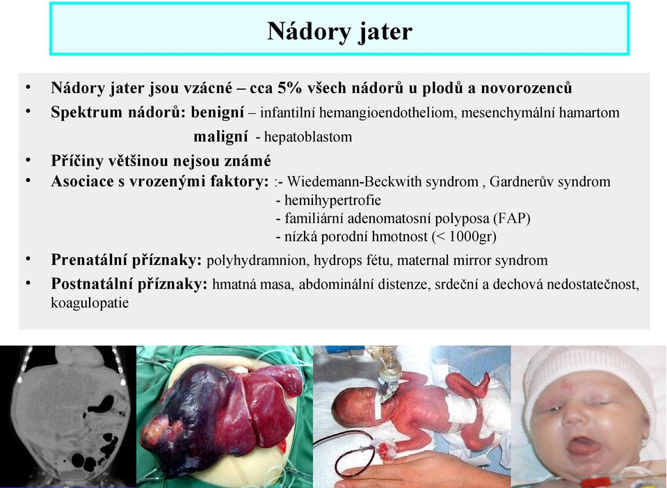 Gardnerův syndrom - hemihypertrofie - familiární adenomatosní polyposa (FAP) - nízká porodní hmotnost (< 1000gr) Prenatální příznaky: