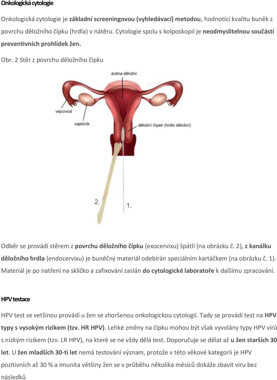 2 Stěr z povrchu děložního čípku Odběr se provádí stěrem z povrchu děložního čípku (exocervixu) špátlí (na obrázku č.