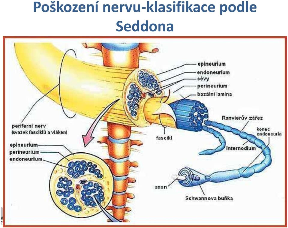 lokalizaci poranění 3.