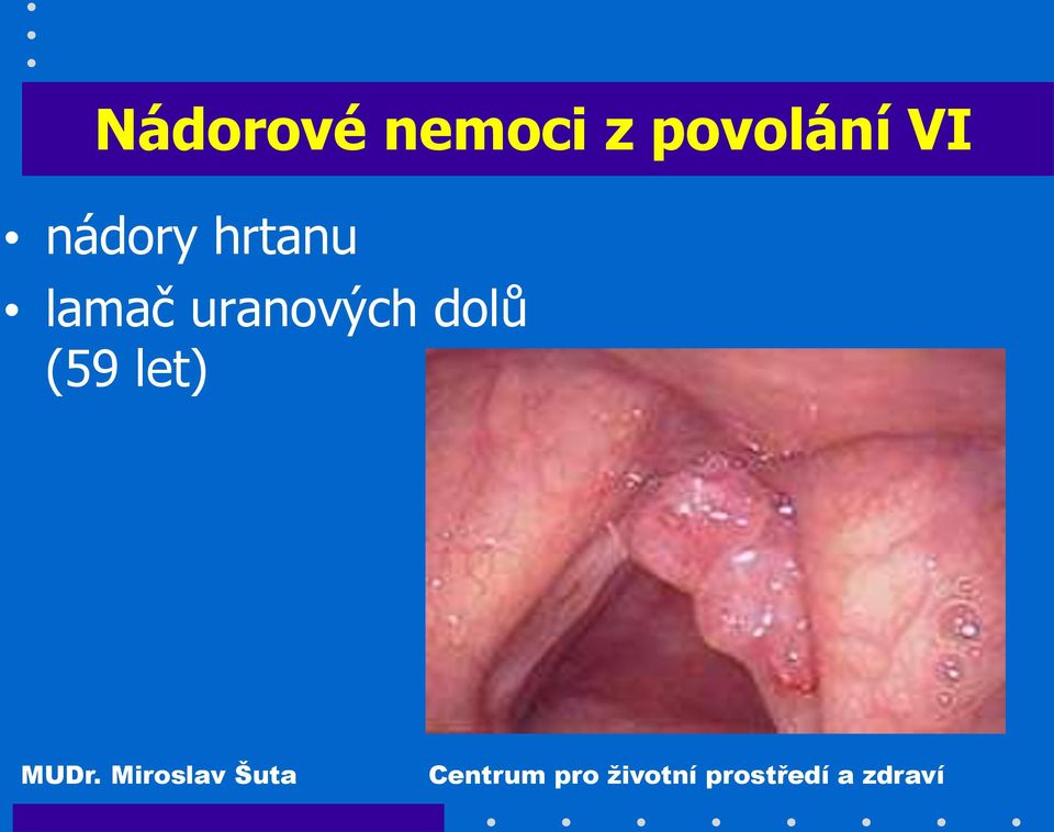 hrtanu lamač