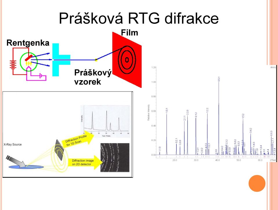 Rentgenka