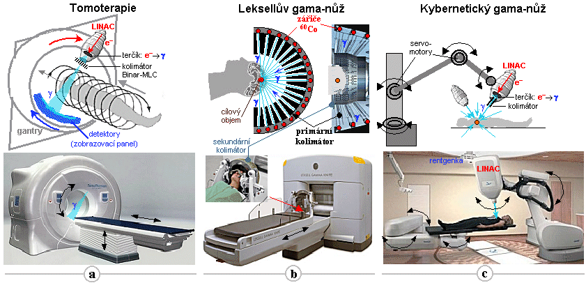 INTEGRACE ZOBRAZOVACÍCH A OZAŘOVACÍCH TECHNOLOGIÍ IGRT - tomoterapie -