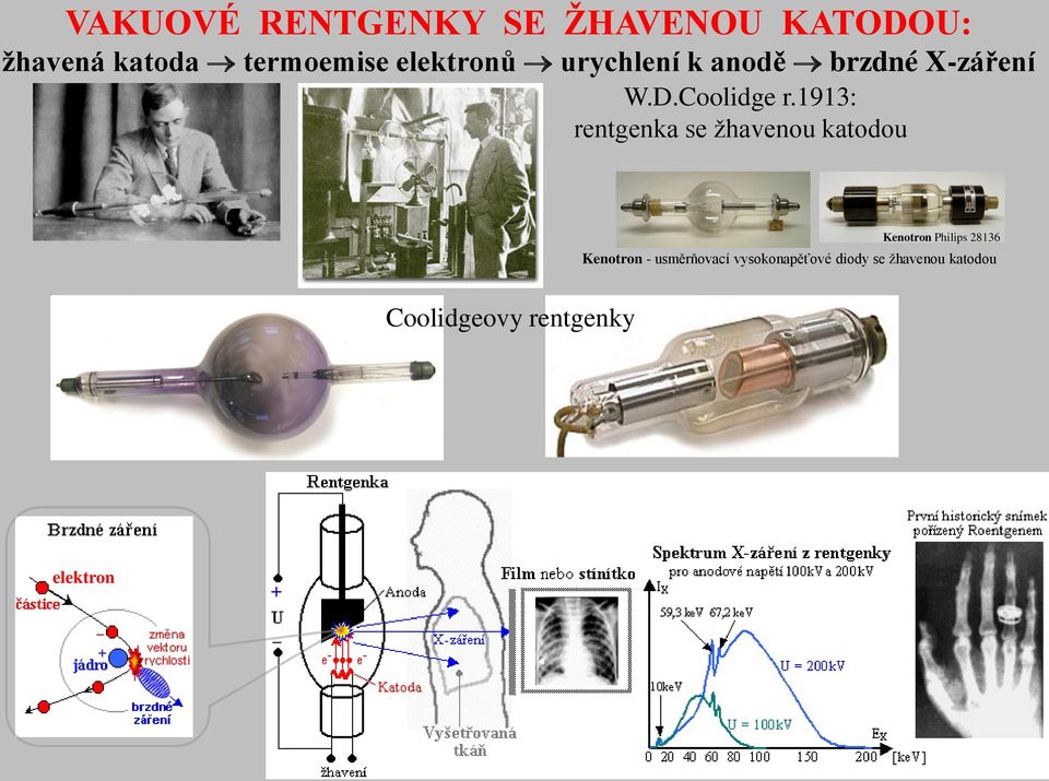 1913: rentgenka se žhavenou katodou Kenotron Philips 28136 Kenotron -