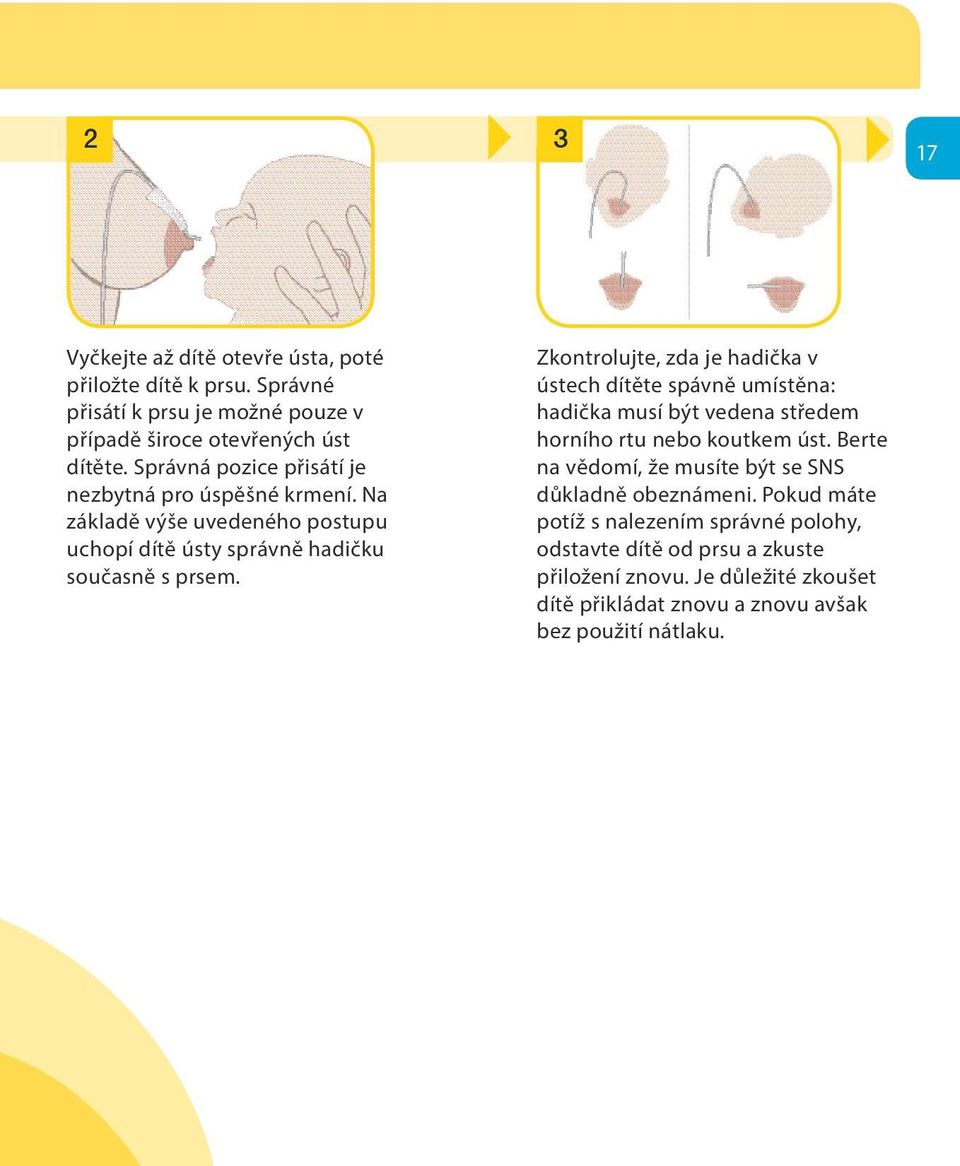 Zkontrolujte, zda je hadička v ústech dítěte spávně umístěna: hadička musí být vedena středem horního rtu nebo koutkem úst.