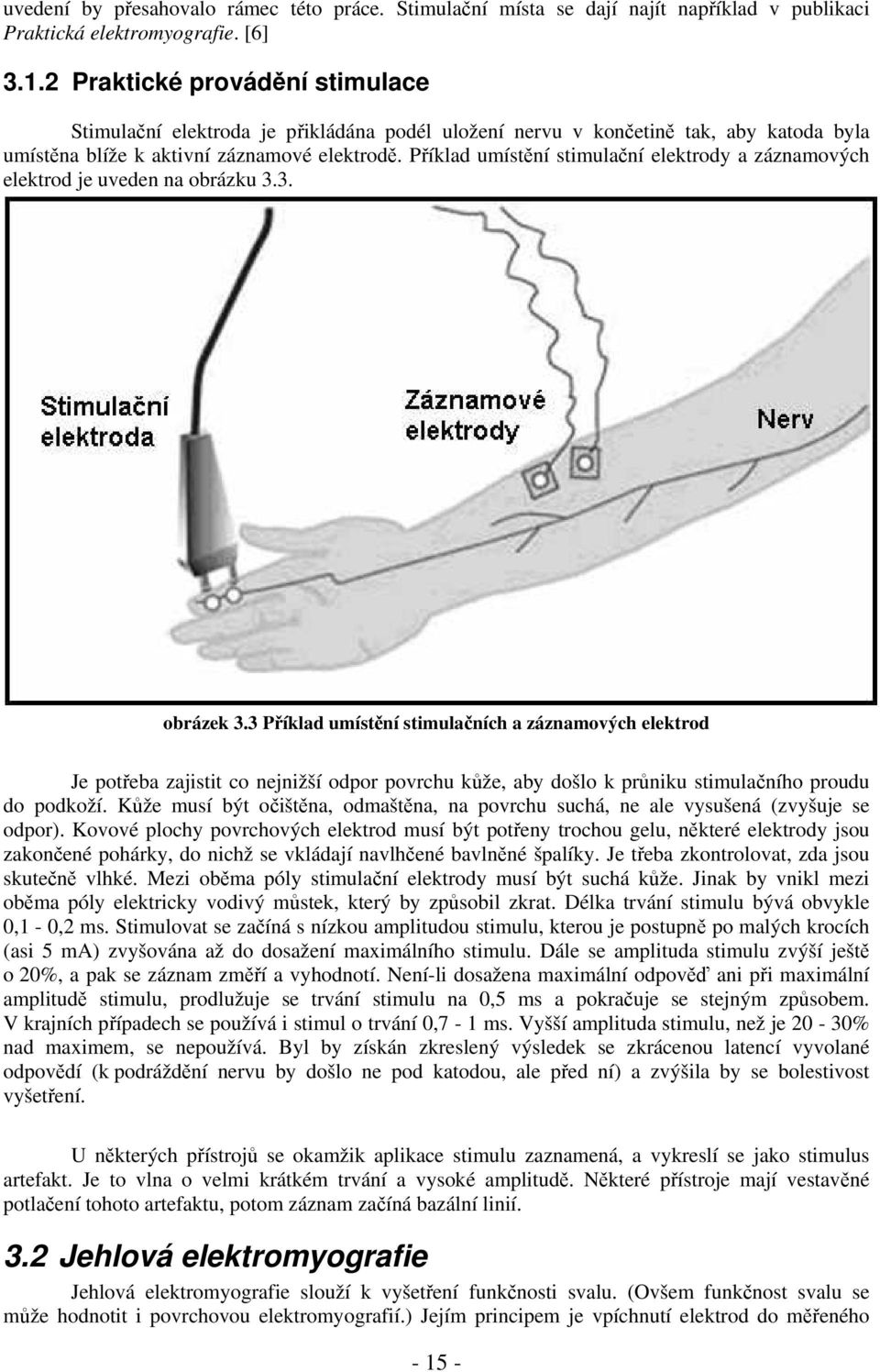 Příklad umístění stimulační elektrody a záznamových elektrod je uveden na obrázku 3.3. obrázek 3.