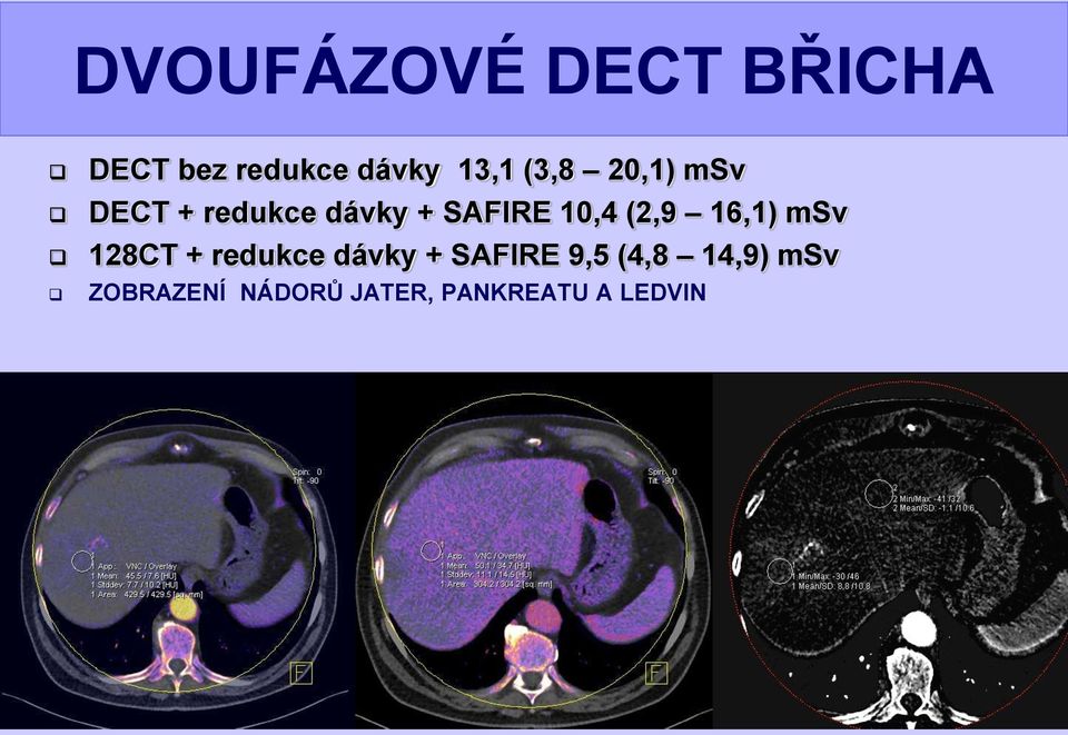 (2,9 16,1) msv 128CT + redukce dávky + SAFIRE 9,5