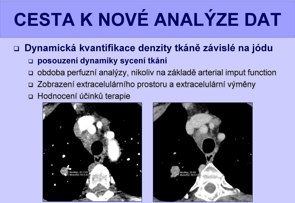 analýzy, nikoliv na základě arterial imput function Zobrazení