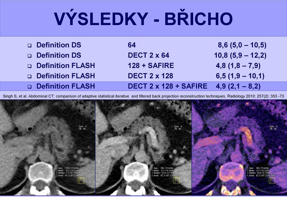 Definition FLASH DECT 2 x 128 + SAFIRE 4,9 (2,1 8,2) Singh S, et al.