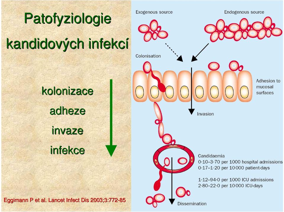 invaze infekce Eggimann P et