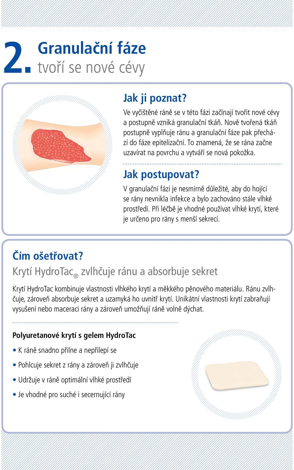 V granulační fázi je nesmírně důležité, aby do hojící se rány nevnikla infekce a bylo zachováno stále vlhké prostředí.