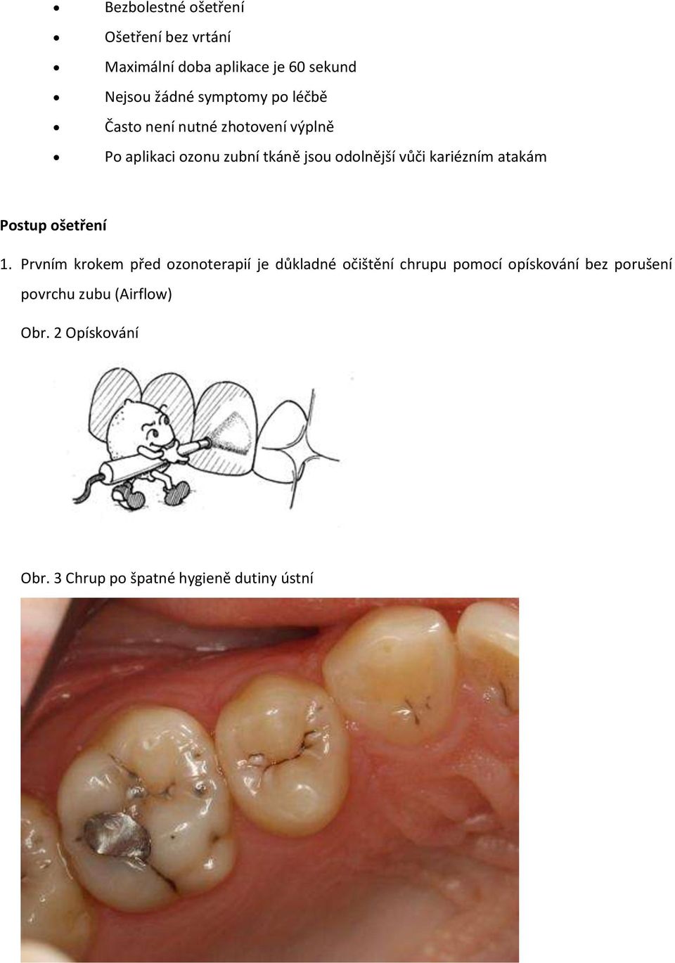 kariézním atakám Postup ošetření 1.