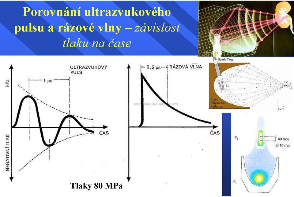 a rázové vlny