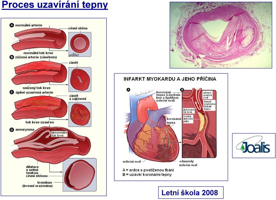 tepny 11