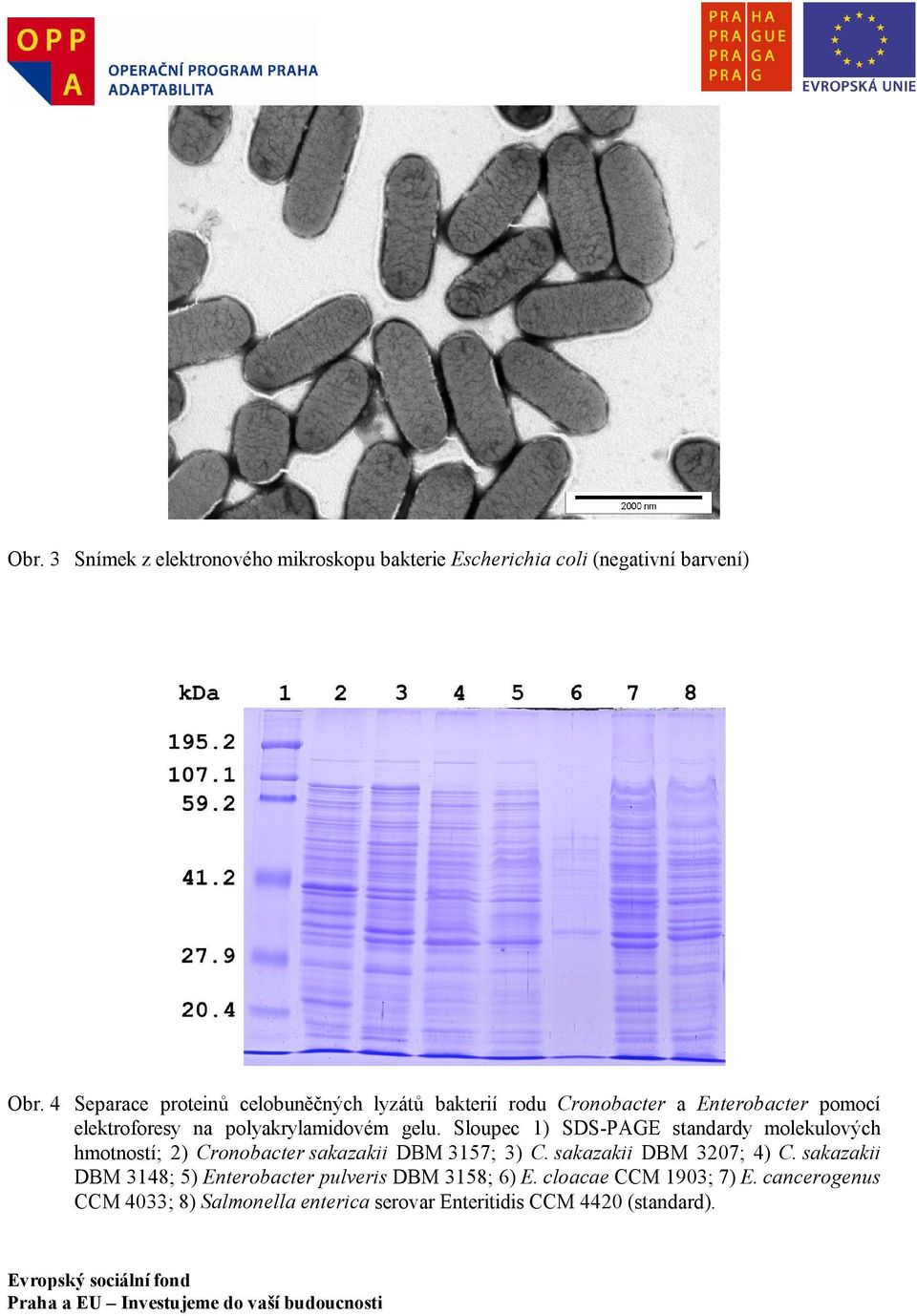 Sloupec 1) SDS-PAGE standardy molekulových hmotností; 2) Cronobacter sakazakii DBM 3157; 3) C. sakazakii DBM 3207; 4) C.