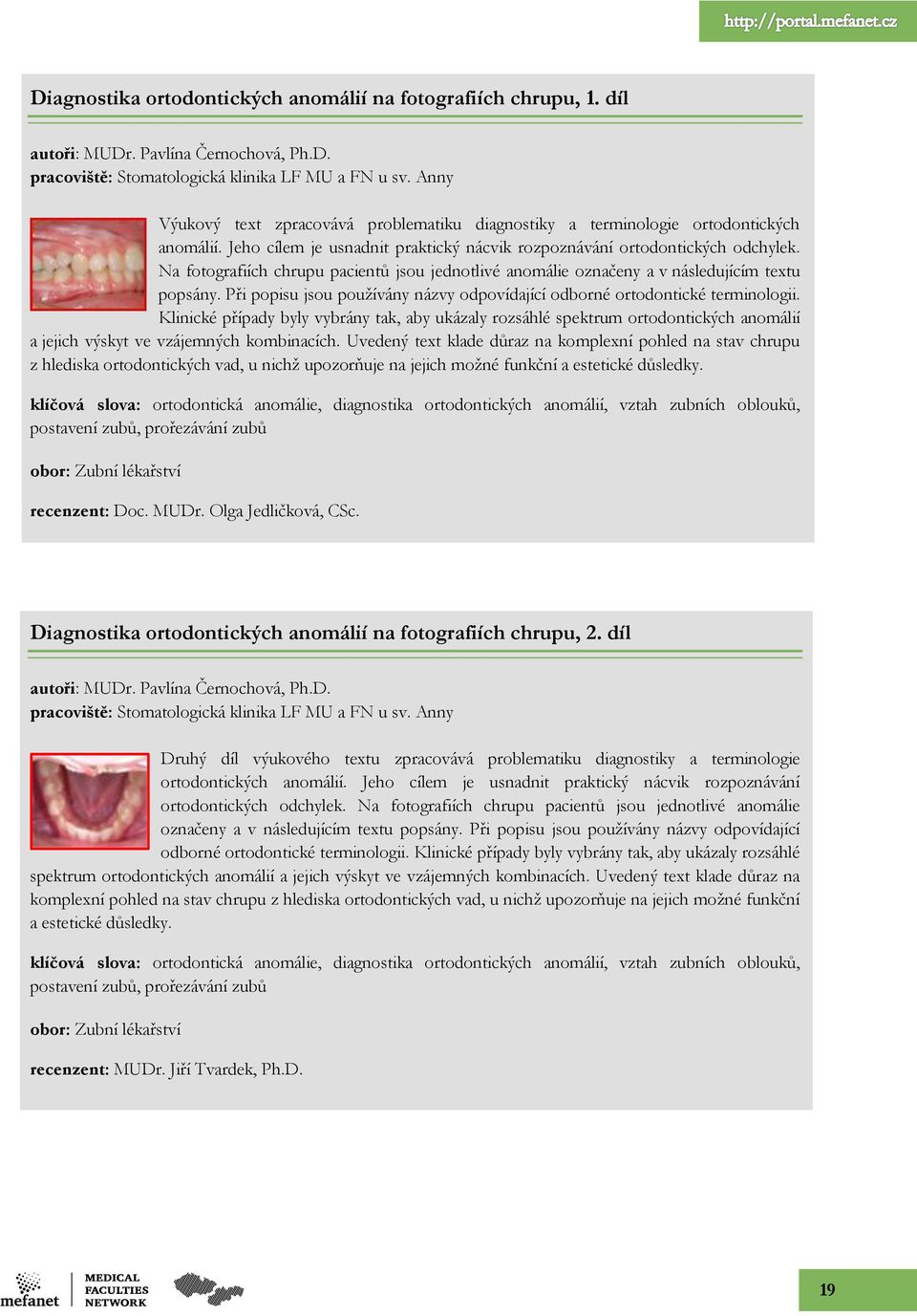 Na fotografiích chrupu pacientů jsou jednotlivé anomálie označeny a v následujícím textu popsány. Při popisu jsou pouţívány názvy odpovídající odborné ortodontické terminologii.