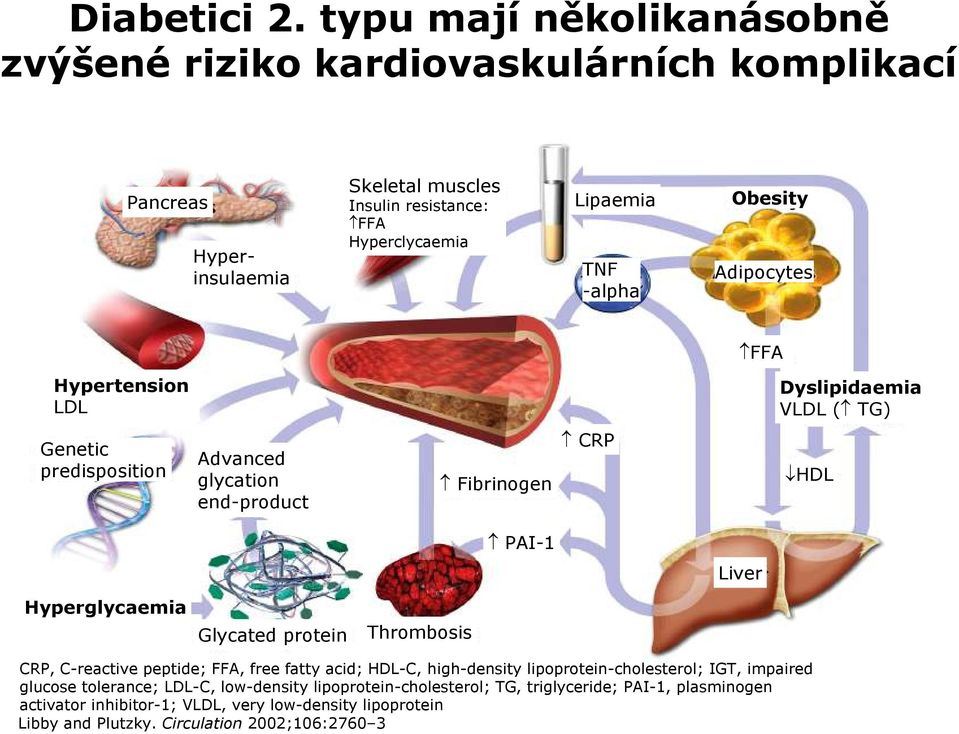 Obesity Adipocytes FFA Hypertension LDL LDL Dyslipidaemia VLDL ( TG) Genetic predisposition Advanced glycation end-product Fibrinogen CRP HDL PAI-1 Liver Hyperglycaemia