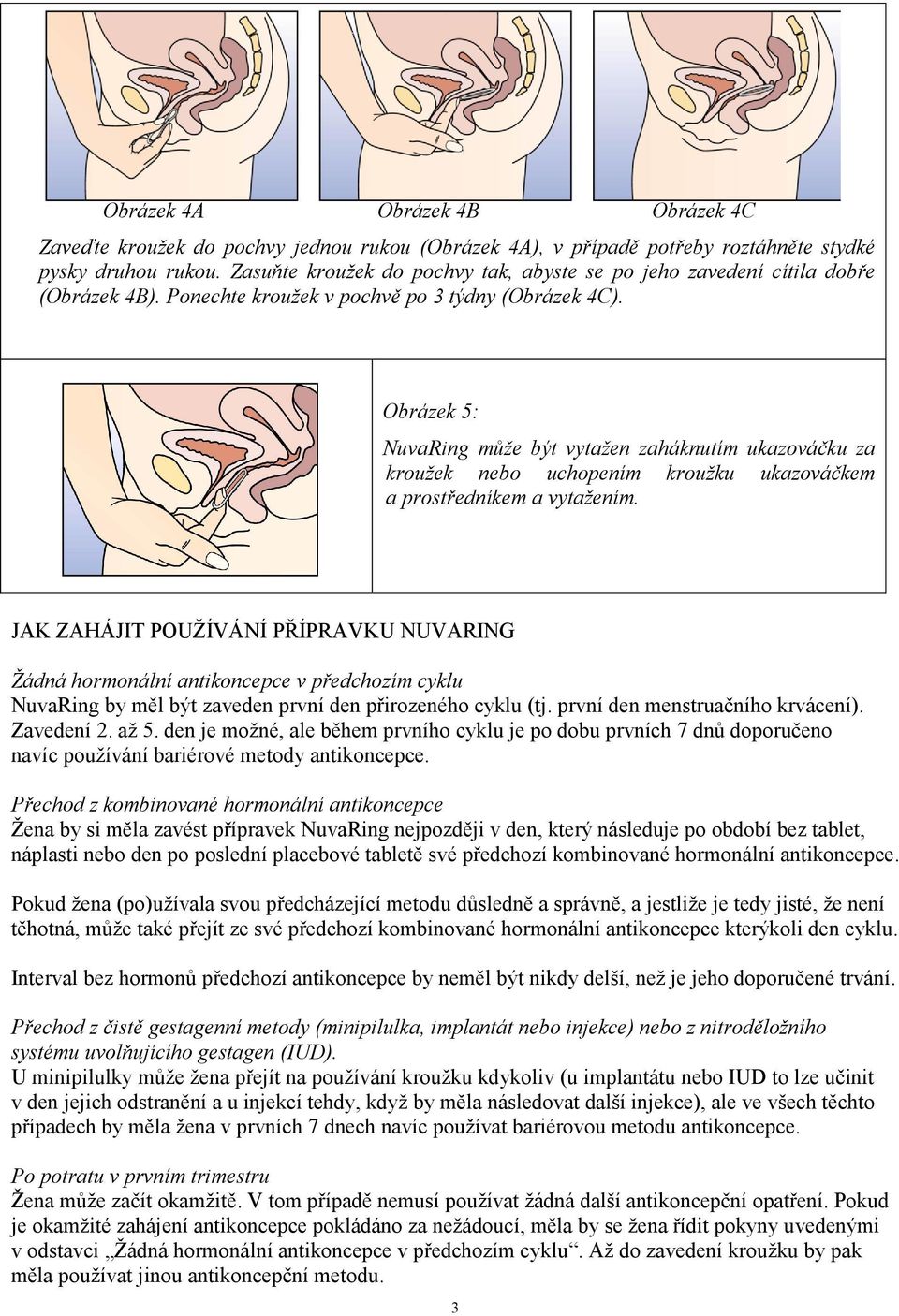 Obrázek 5: NuvaRing může být vytažen zaháknutím ukazováčku za kroužek nebo uchopením kroužku ukazováčkem a prostředníkem a vytažením.